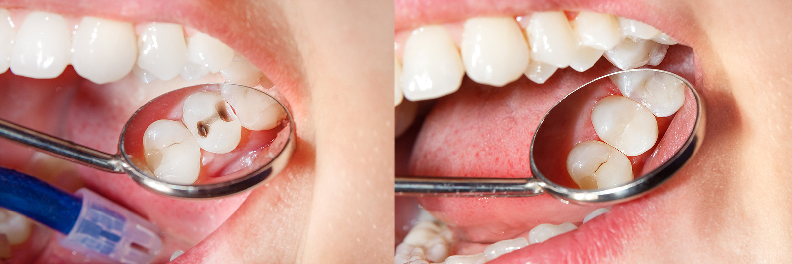 Universal Dental Spa Universal Dental Spa