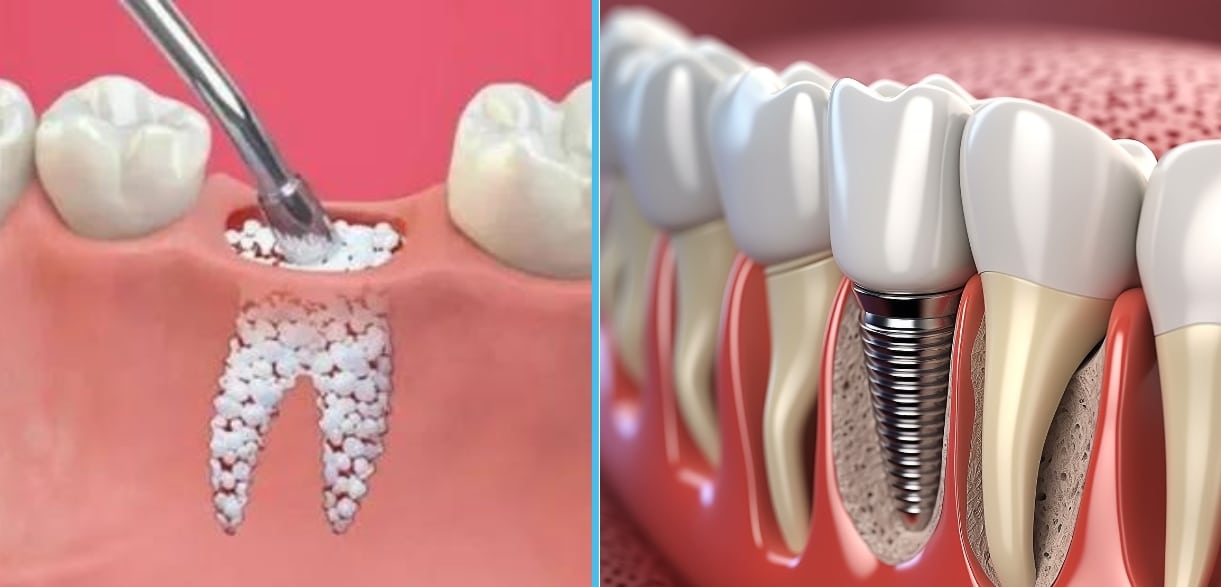 Universal Dental Spa