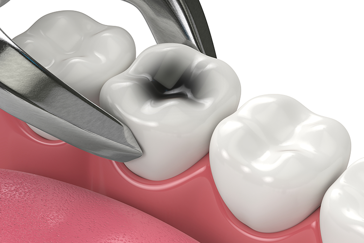 Universal Dental Spa